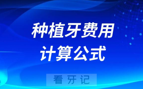 种植牙费用计算公式查一查做种植牙要花多少钱