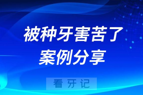 愤怒！我被种牙害苦了种牙痛苦经历分享