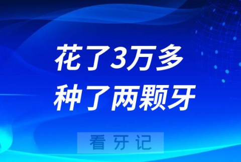 十年时间做了三次种牙手术花了3万多种了两颗牙