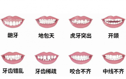 牙齿畸形矫正牙齿价格一览表2023-2024