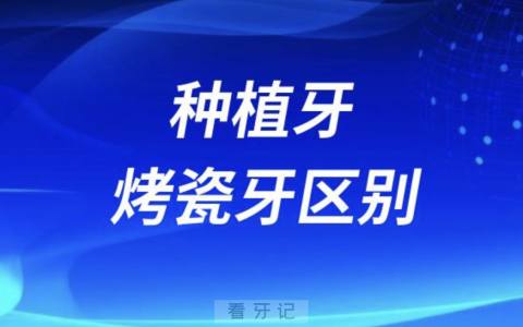 种植牙和烤瓷牙的区别有哪些？附五大区别整理