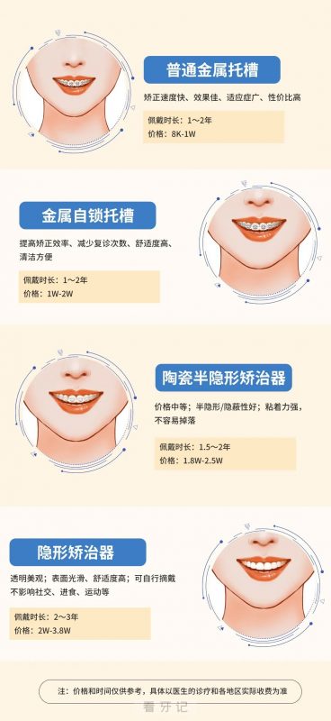 国内常见四种牙套及价格盘点 2023-2024
