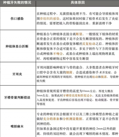 牙医未必告诉你的种植牙失败风险五大原因盘点附图片