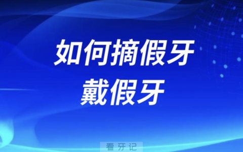 如何摘假牙戴假牙？新手教程攻略来了