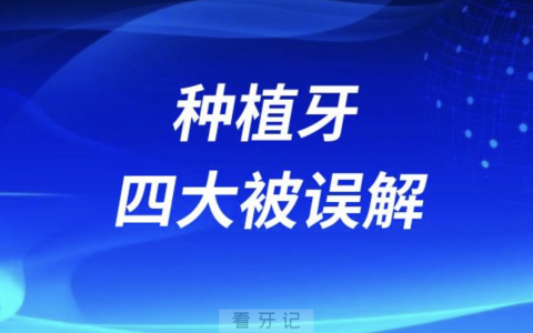 种植牙四大误解谎言盘点