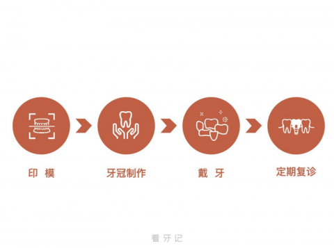 完整真实的种植牙流程是怎样的？最新图文解读来了