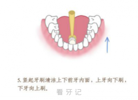 巴氏刷牙法分步骤高清图片