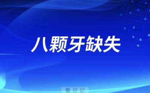 八颗牙缺失是做种植牙好还是镶假牙好？最新解读来了