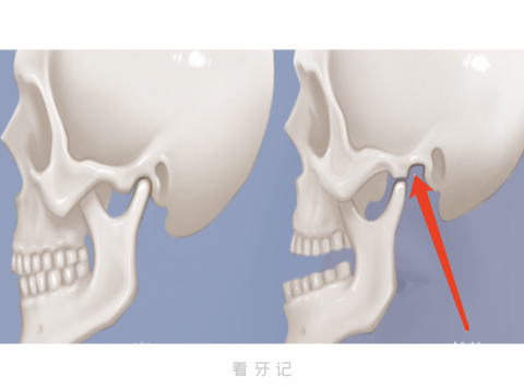 掉下巴是什么意思？最新图片解读来了！