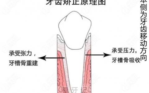 拔牙矫正后其他牙齿会更容易掉么？答案来了