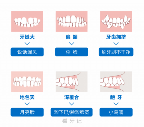 良心牙医告诉你错颌畸形六大典型症状