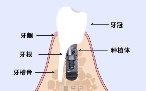 什么是植骨？是不是对身体不好？非常疼？