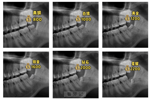最贵的智齿长什么样？最新照片来了