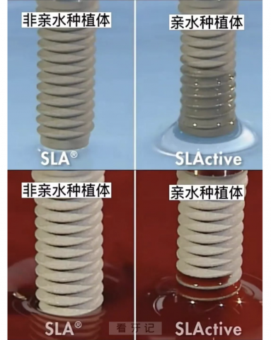 非亲水种植体和亲水种植体区别图片对比