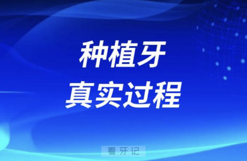 良心牙医告诉你种植牙真实过程