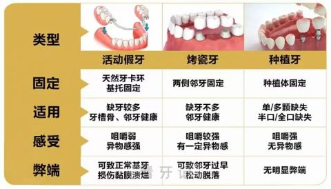 不同假牙寿命是多久？最新解读来了