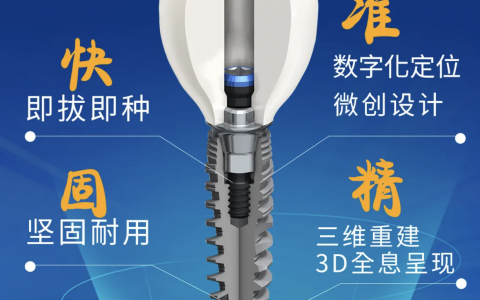 立得用种植牙介绍