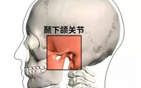 缺牙导致颞下颌关节咬合紊乱