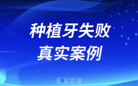 被种植牙害苦了真实案例