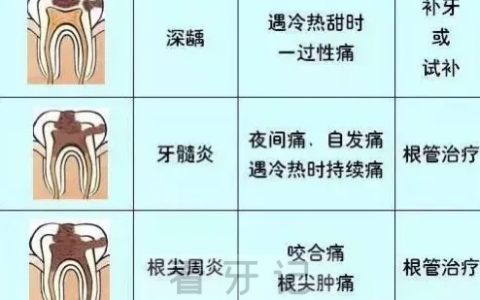 哪些牙需要做根管治疗？