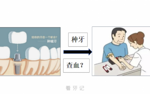 种牙有没有必要查血？种牙不查血会怎么样？