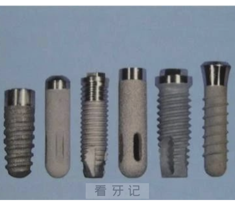 国内十大种植牙品牌前十名单公布