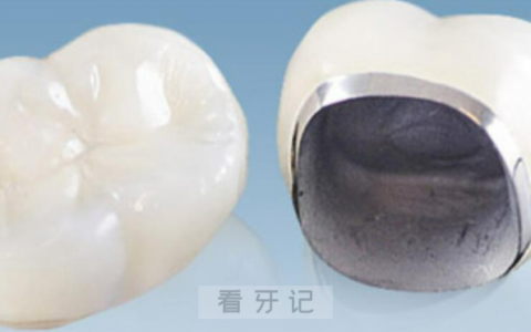 国内十大全瓷牙冠品牌排行榜前十名单
