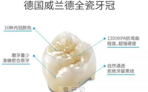 德国全瓷牙怎么样？有哪些品牌值得推荐？