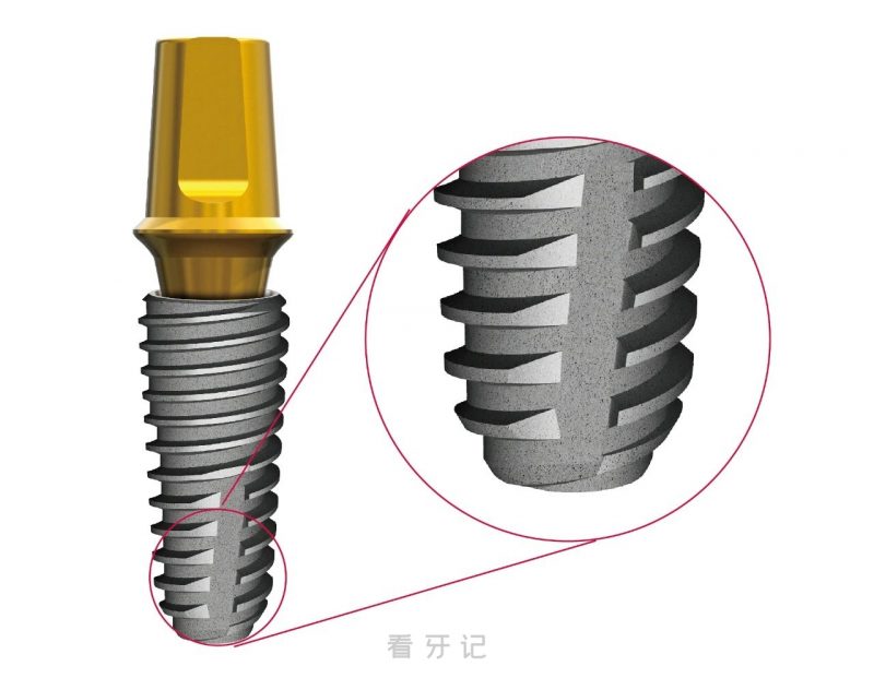 沃兰种植牙和T-PLUS哪个更好？是哪个国家的品牌？