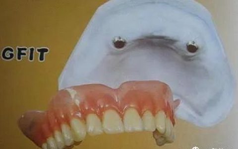 高中低档品牌义齿吸附性假牙价格盘点