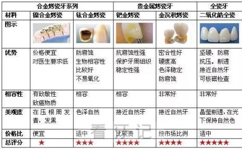烤瓷牙全瓷牙对比图（优缺点、推荐指数）