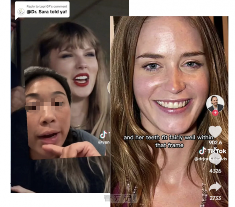 后悔死了？千万别做牙齿贴面，可能真的不适合你！