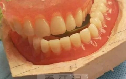 良心医生建议老年人选吸附性义齿还是做种植牙
