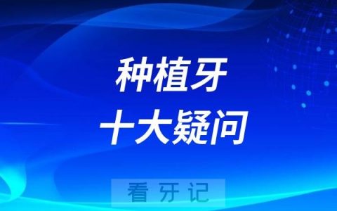 良心牙医的种植牙十大疑问