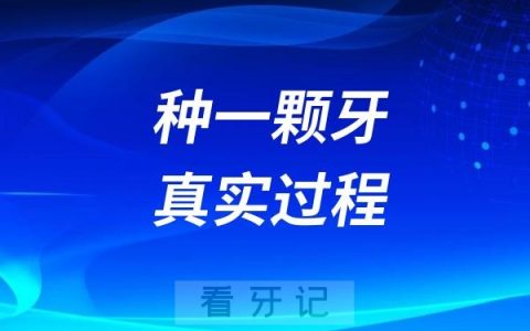 分享去口腔医院种一颗牙的真实过程