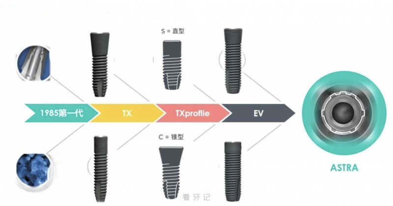 世界第三大种植体Astra是哪个国家的？好在哪里？六大优势整理