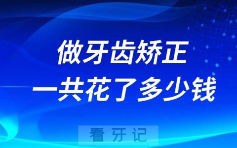 大家做牙齿矫正一共花了多少钱？各地最新牙套价格表出炉！正畸前必看！