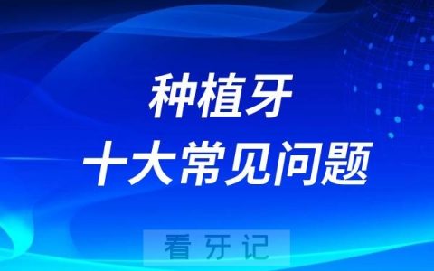 种植牙十大常见问题及解答