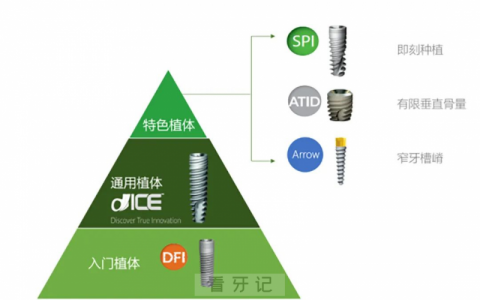 瑞典诺贝尔种植体和德国卡瓦ABT种植体哪个更好？
