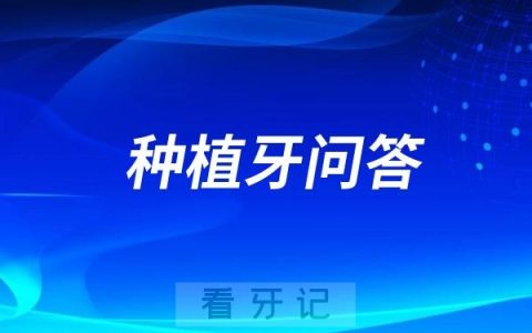 诺贝尔和iti有什么区别？两者那个档次高？差别有多大？