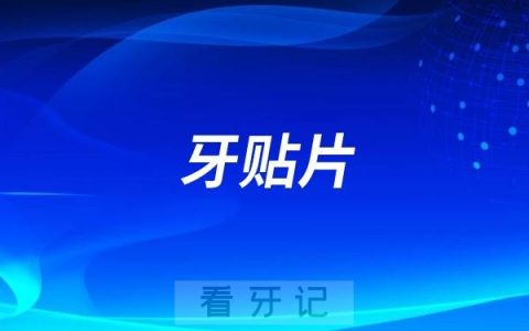 牙贴片避坑指南！做牙贴片前你必须要知道的五件事