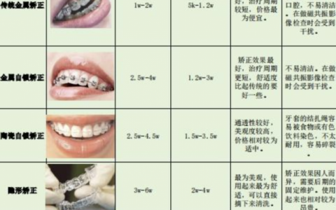 盘点国内主流的六大牙套类型！看看那种最好？
