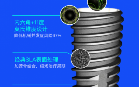 瑞士士卓曼T-ST系列种植牙怎么样？档次高吗？质量靠不靠谱？