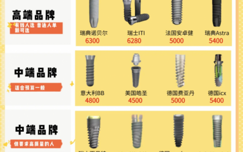 2025年最热门的十二款种植牙品牌名单及价格汇总