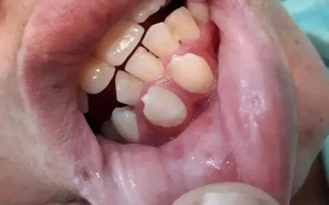 大人会不会长双排牙，看完这个图片震惊到了！