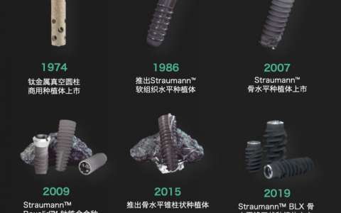士卓曼种植体有哪些型号和系列？最新图文解读来了