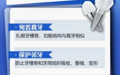 一张图告诉你为什么要选择种植牙？种植牙有哪些优势？