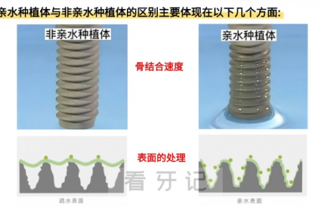 瑞士iti种植体亲水和非亲水哪个更好？有什么区别？