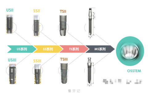 韩国奥齿泰属于什么级别的品牌？韩国奥齿泰种植体型号及价格揭秘