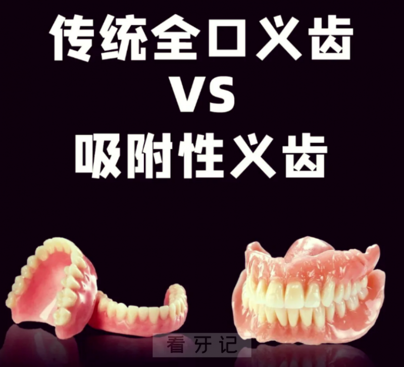 为什么良心医生不建议做吸附式假牙？全口吸附性义齿和普通义齿的区别在哪里?